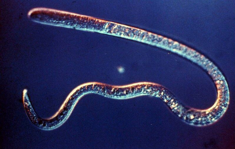 worm parasite from the human body