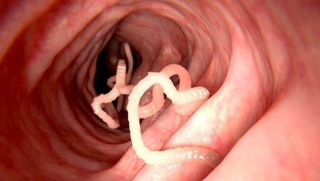 Worms that live in the human intestines
