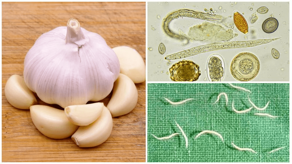 parasites in the body folk methods