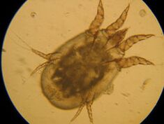 Tick ​​under a microscope
